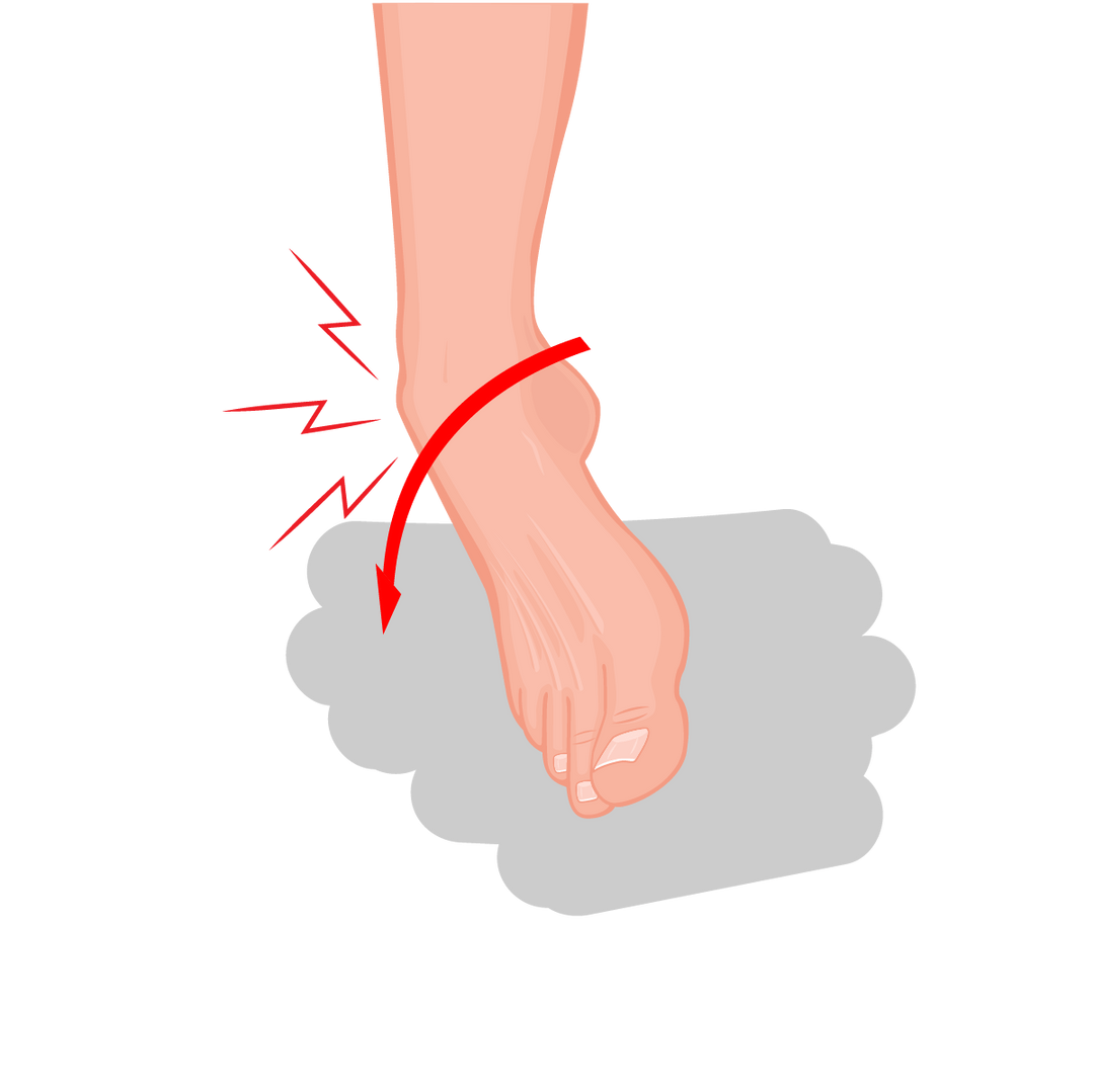 Lateral Ankle Sprain Diagnosis, Causes & Treatments